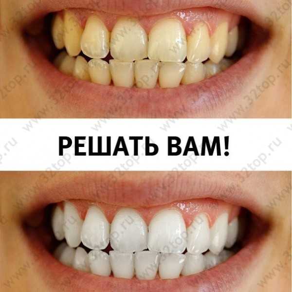 Студия косметического отбеливания зубов WHITE & SMILE
